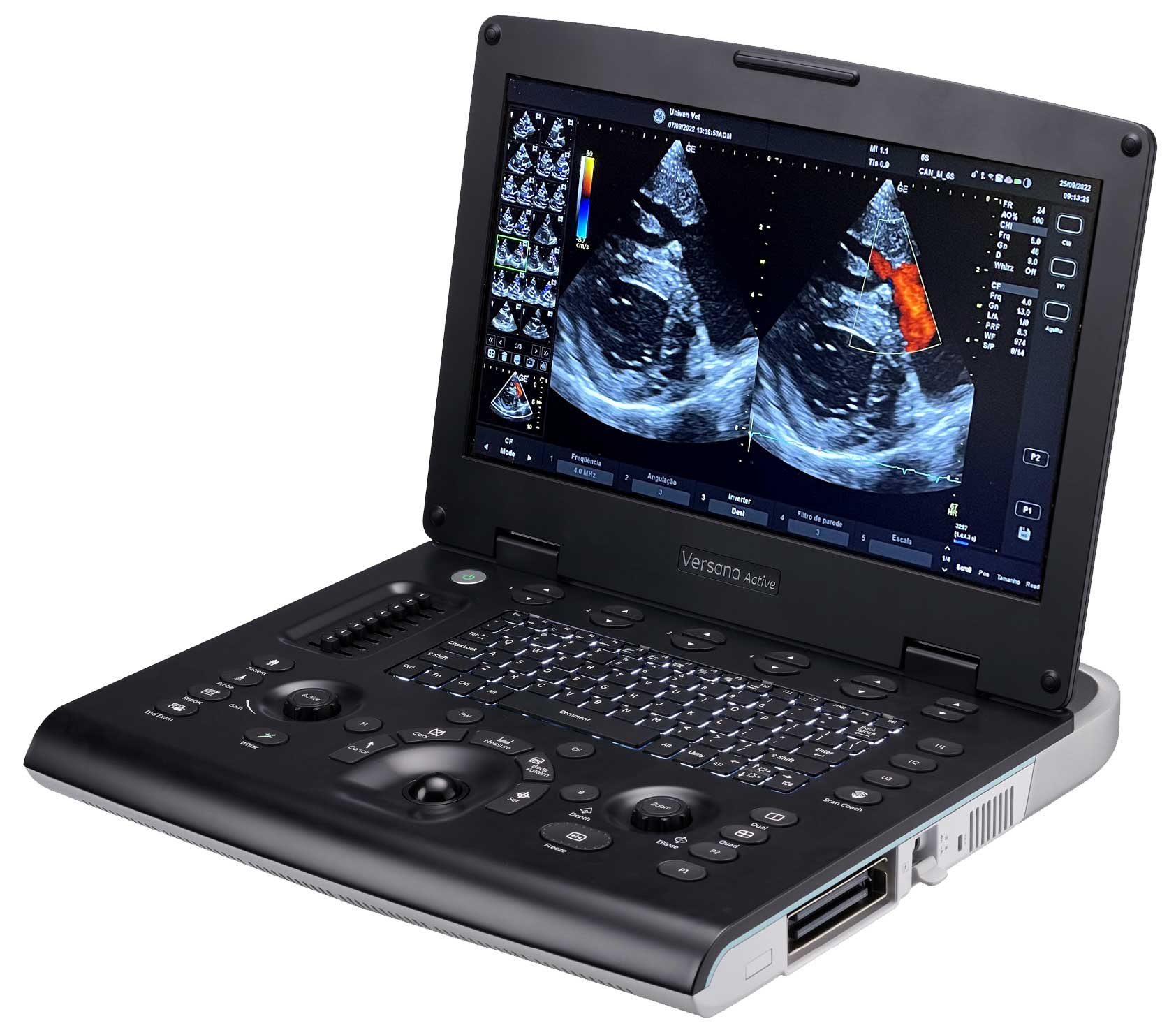 Versana-Active_CARDIO